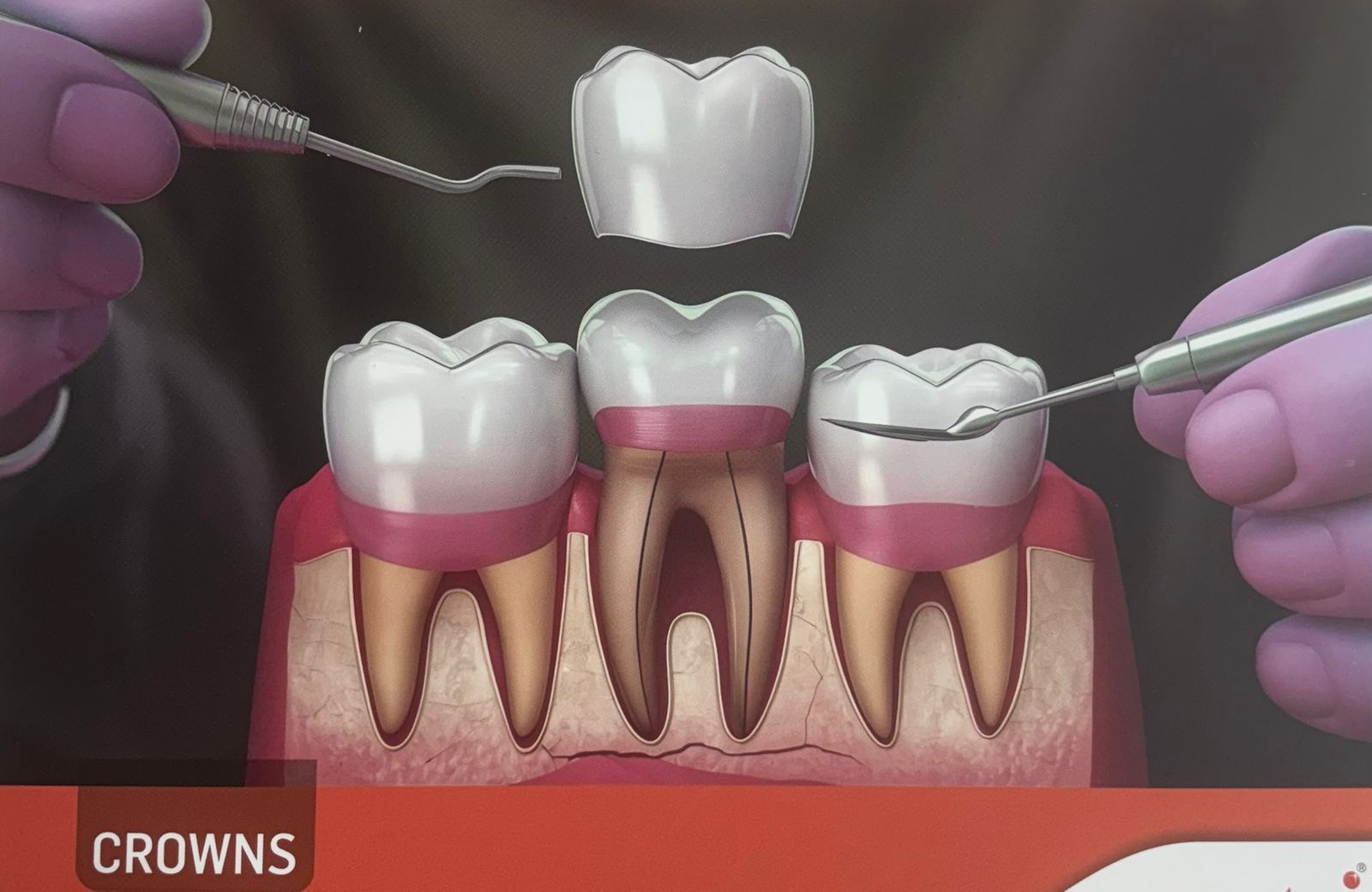 Restorative Dentistry